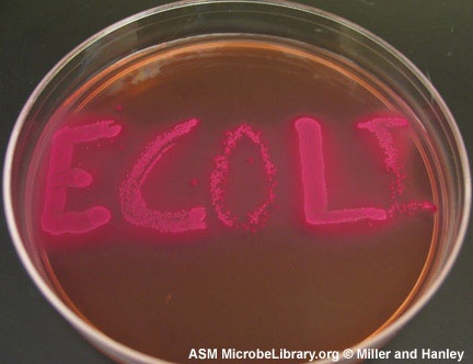 Escherichia_coli_fig5.jpg