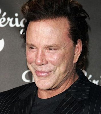 Mickey_Rourke_Plastic_Surgery.jpg