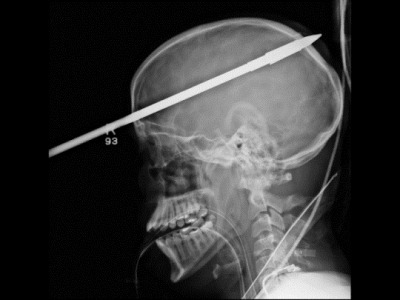 Spear_in_Head_1_540x405.jpg